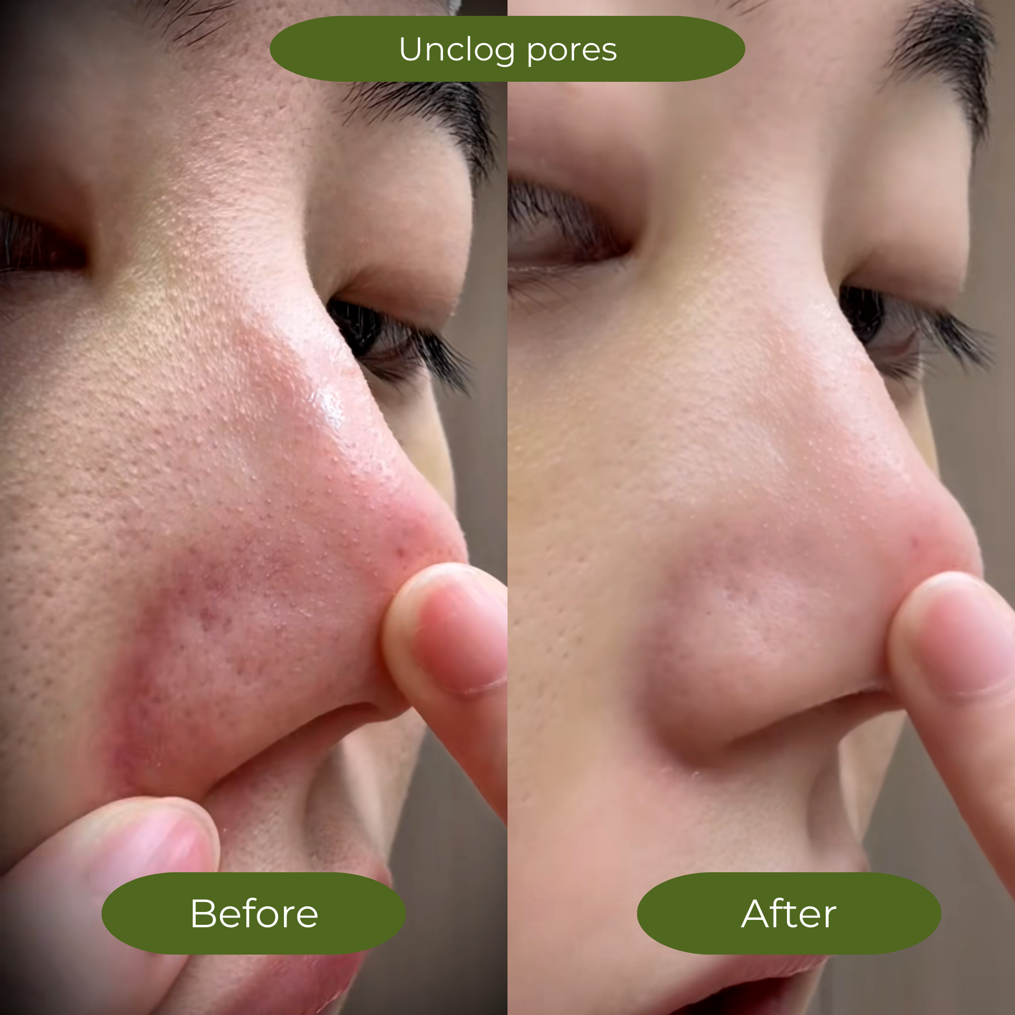 3 Minute Korean Bubble Mask for Glowing & Smooth Skin