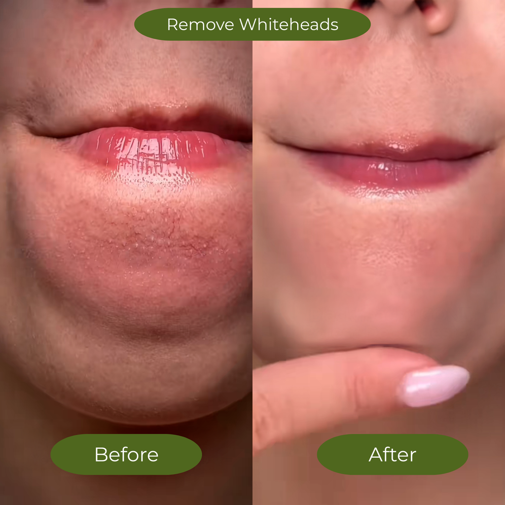 3 Minute Korean Bubble Mask for Glowing & Smooth Skin